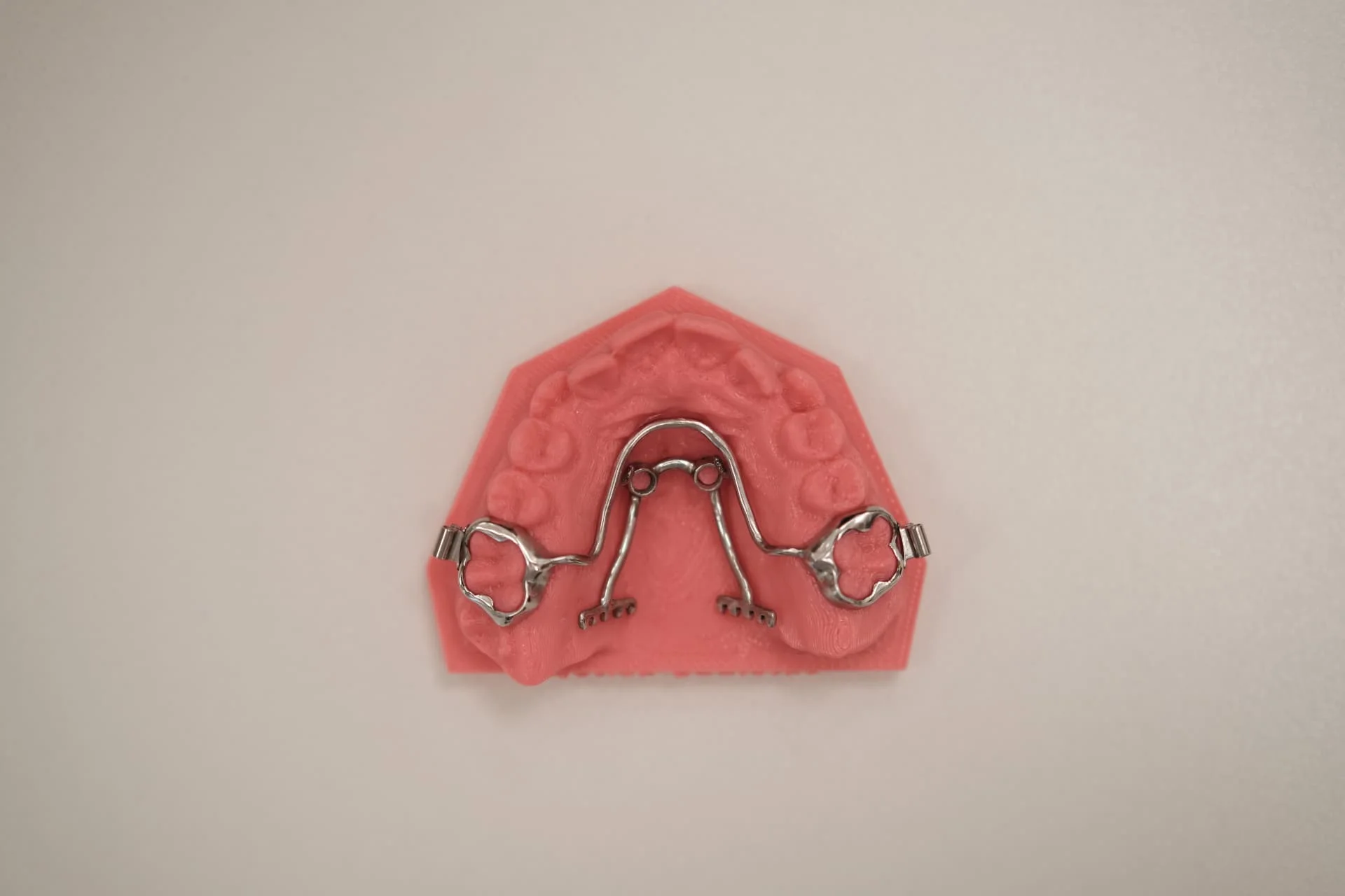 MCPP fogszabályozó rendszer készüléke rózsaszín 3D nyomatmodellen